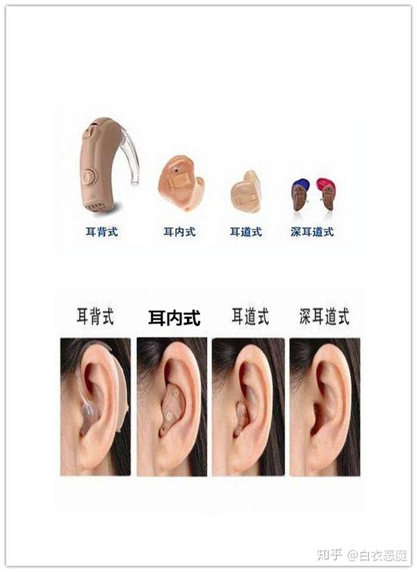 什么时候该用助听器?怎么选?