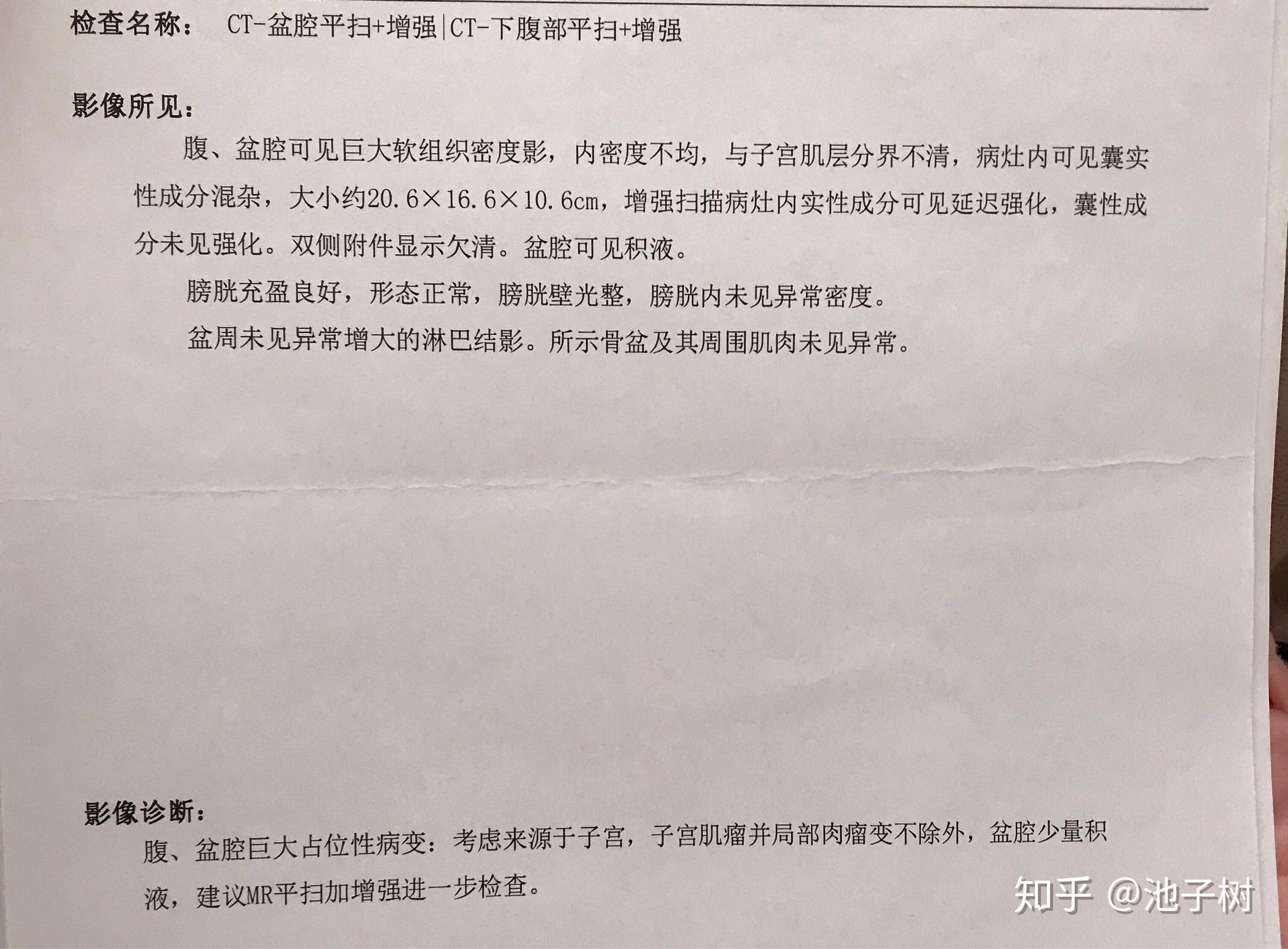 子宫肌瘤开腹手术经历