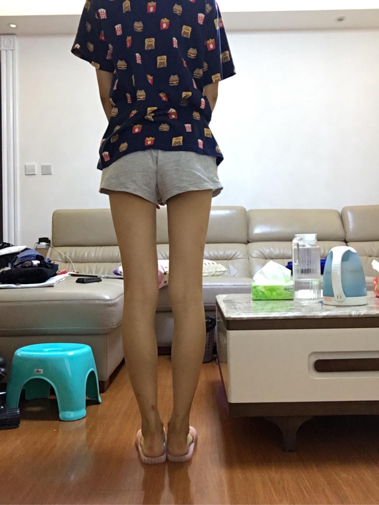 身高171,体重55,大腿围49,小腿围30,总觉得自己大小腿比例失调,是我的