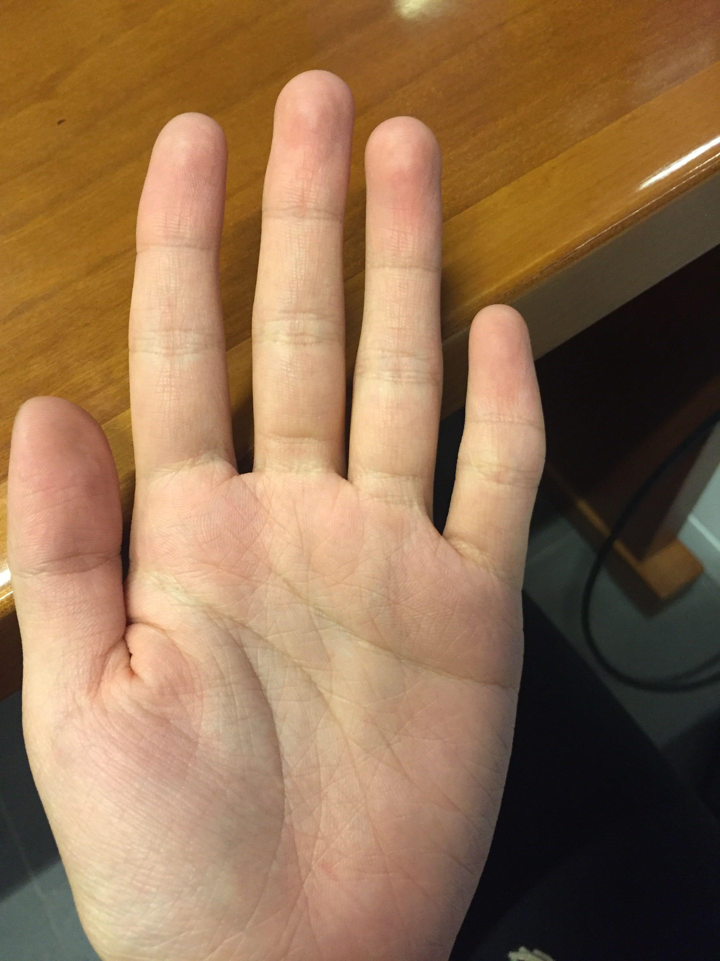 五岁小女孩想学小提琴老师说手指条件不够好左手手指有些短学小提琴