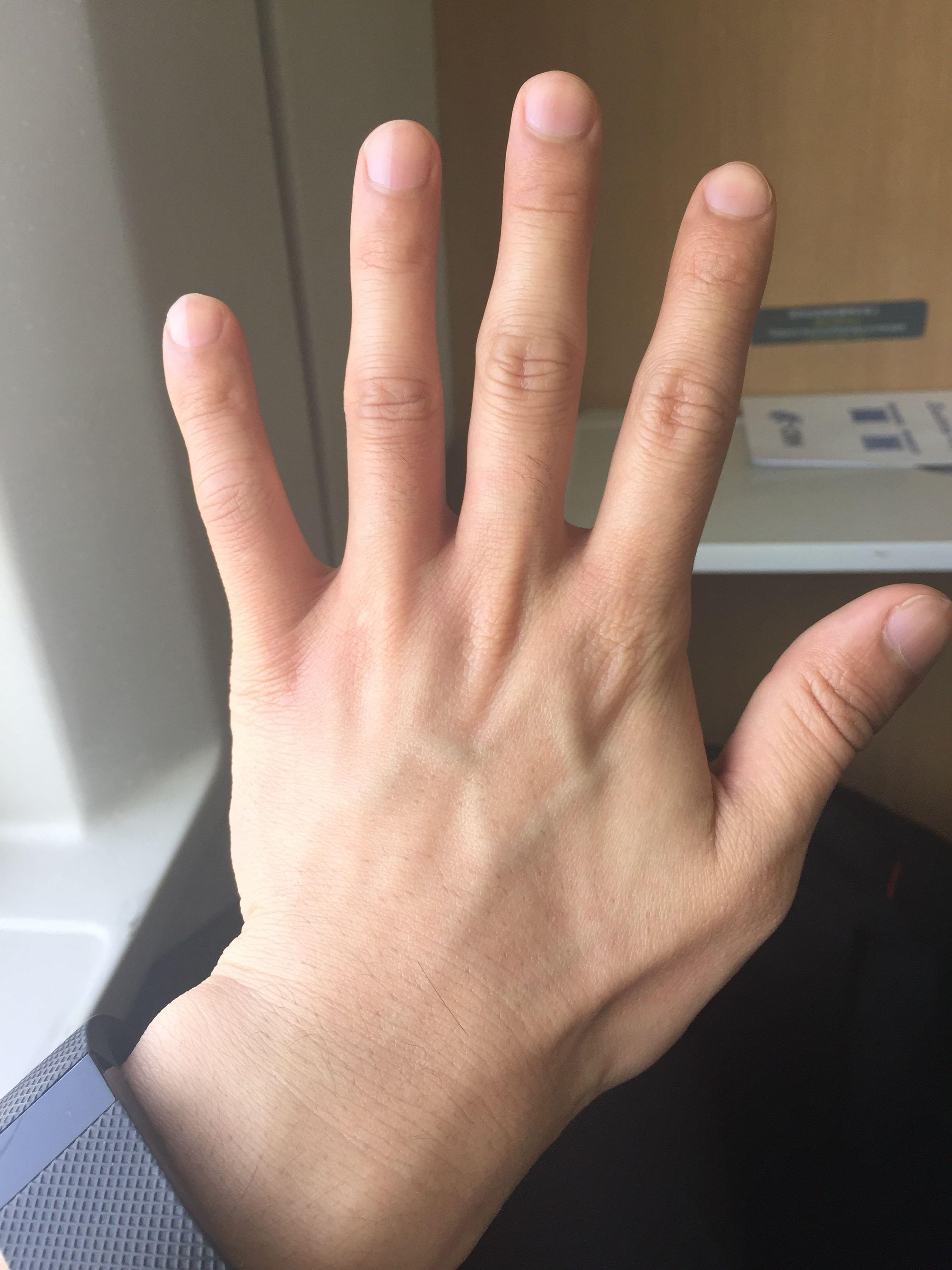 女生的手丑成这样怎么办