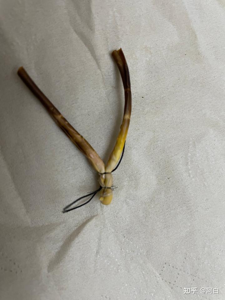 吾承平安 的想法: 肛瘘手术这个橡皮筋是怎么用的,求解释