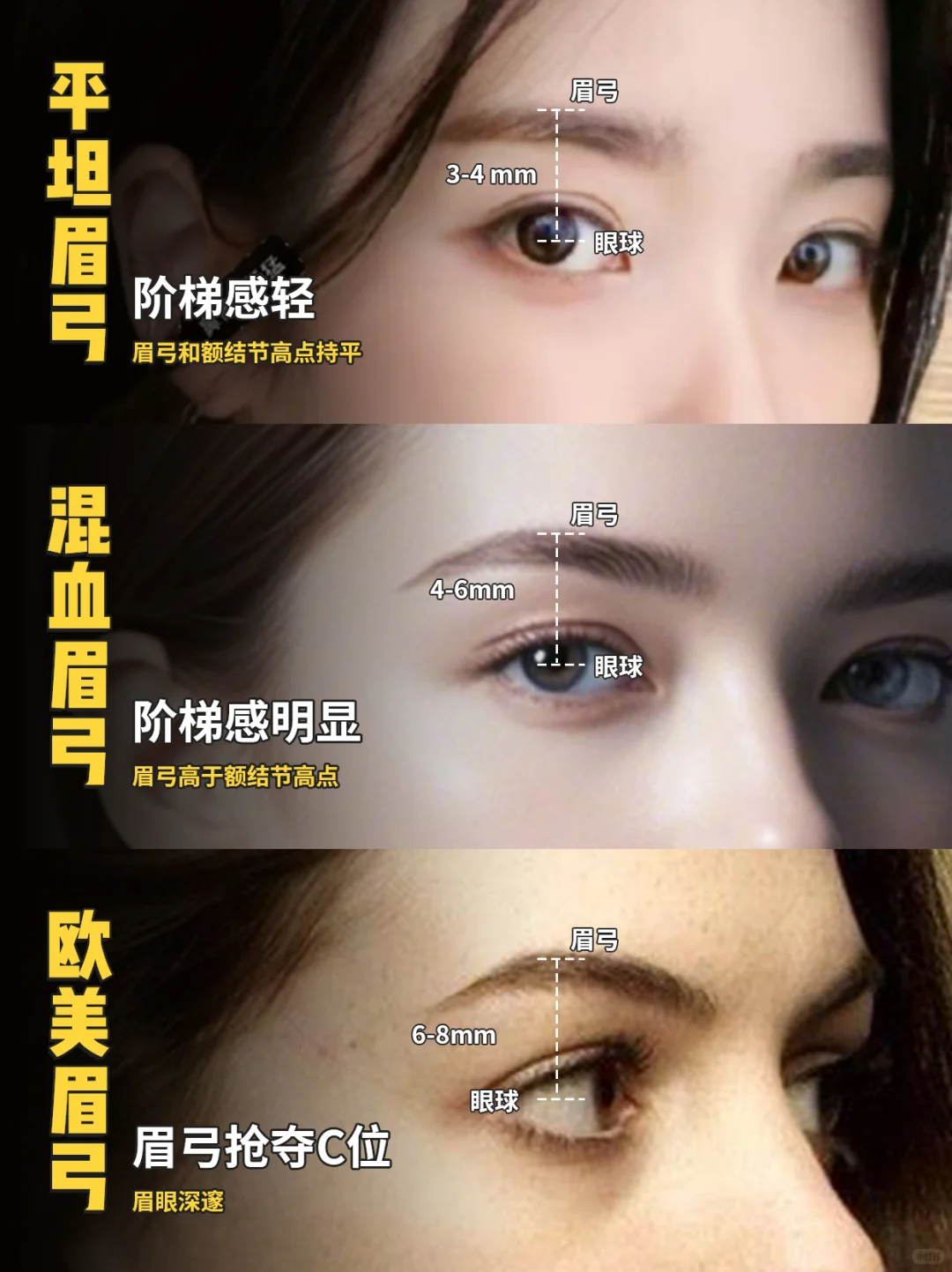 成都史宁 的想法: 眉弓对整体面容的影响增加深邃感:明显的眉弓能加深眼窝,让眼睛更有神采,常见于欧美人群。 调整三庭… - 知乎