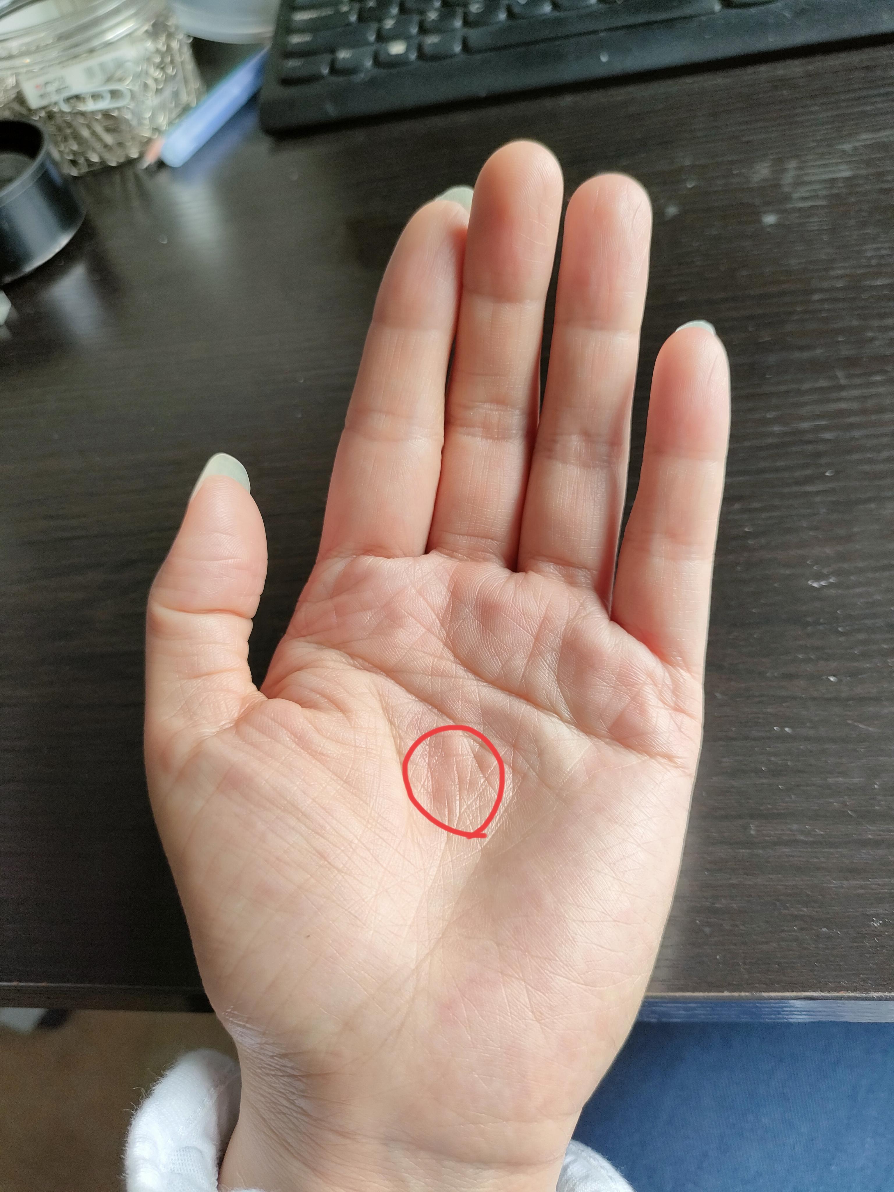 左手掌心正中间疼 知乎