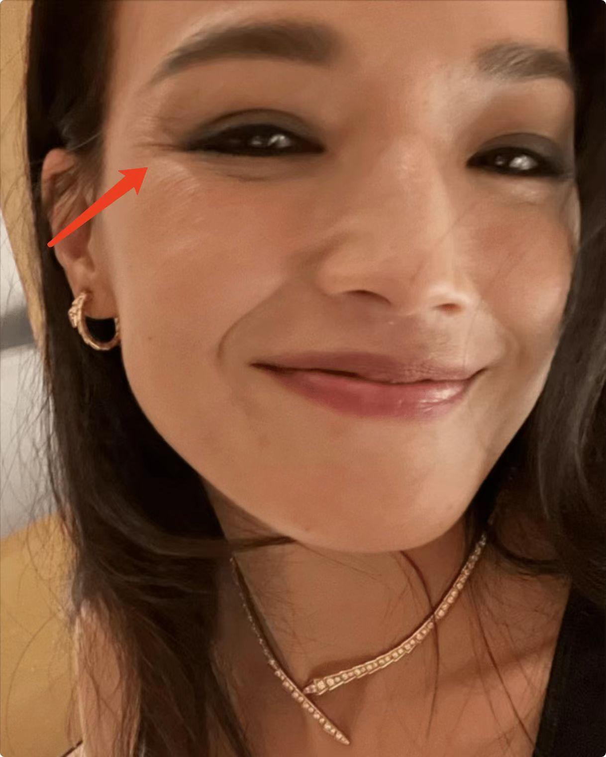  br> br>舒淇的皱纹,到底打了谁的脸?