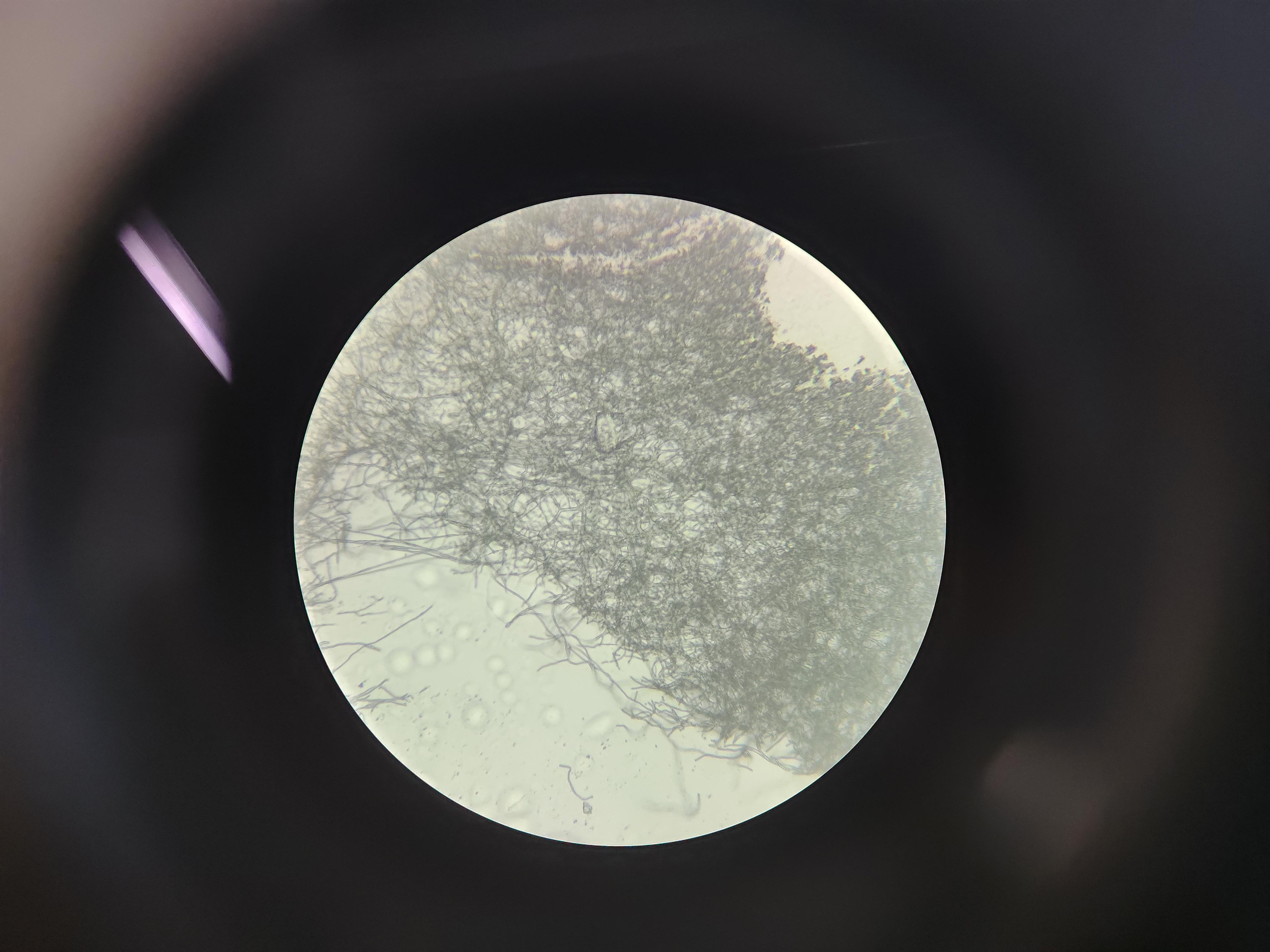 是个俗人 的想法: 显微镜下 | <a class="hash_tag" href="