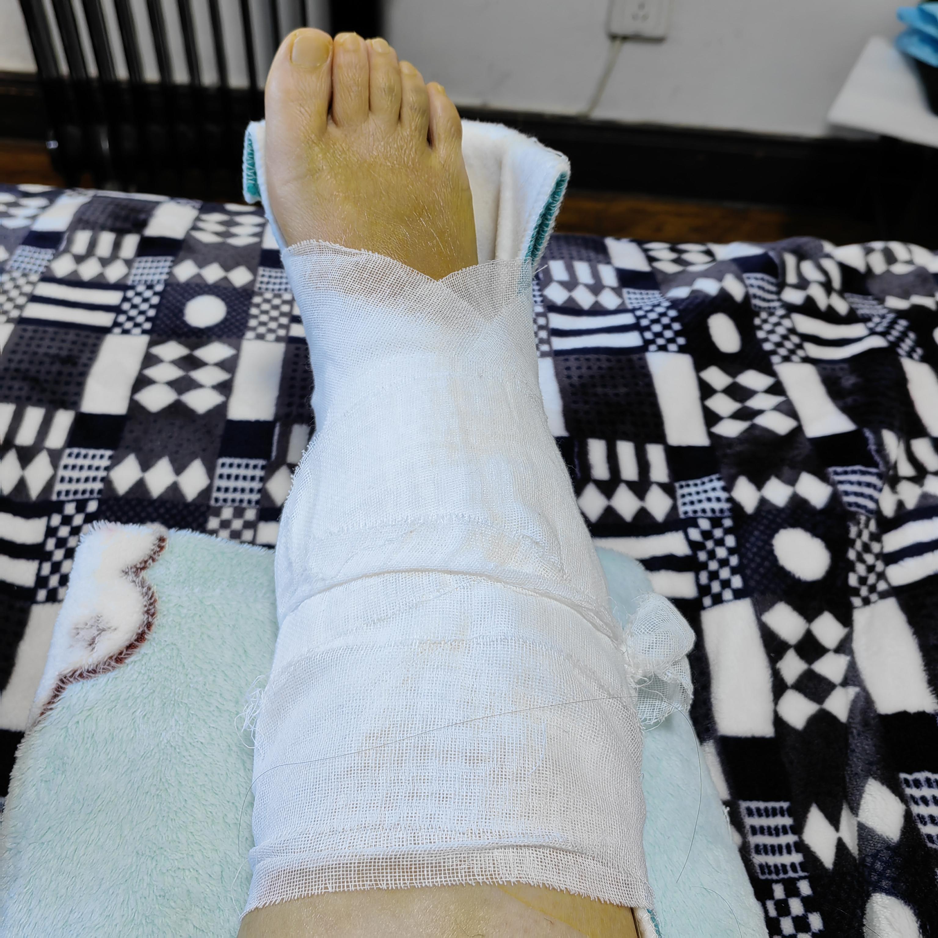 自己骑车摔骨折住院亲人两口子闹离婚我要怎么笑对人生