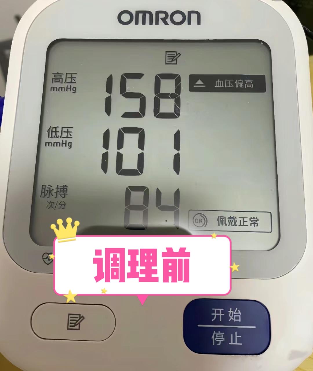 朱先生今年34岁高血压发现三年多高压150低压90