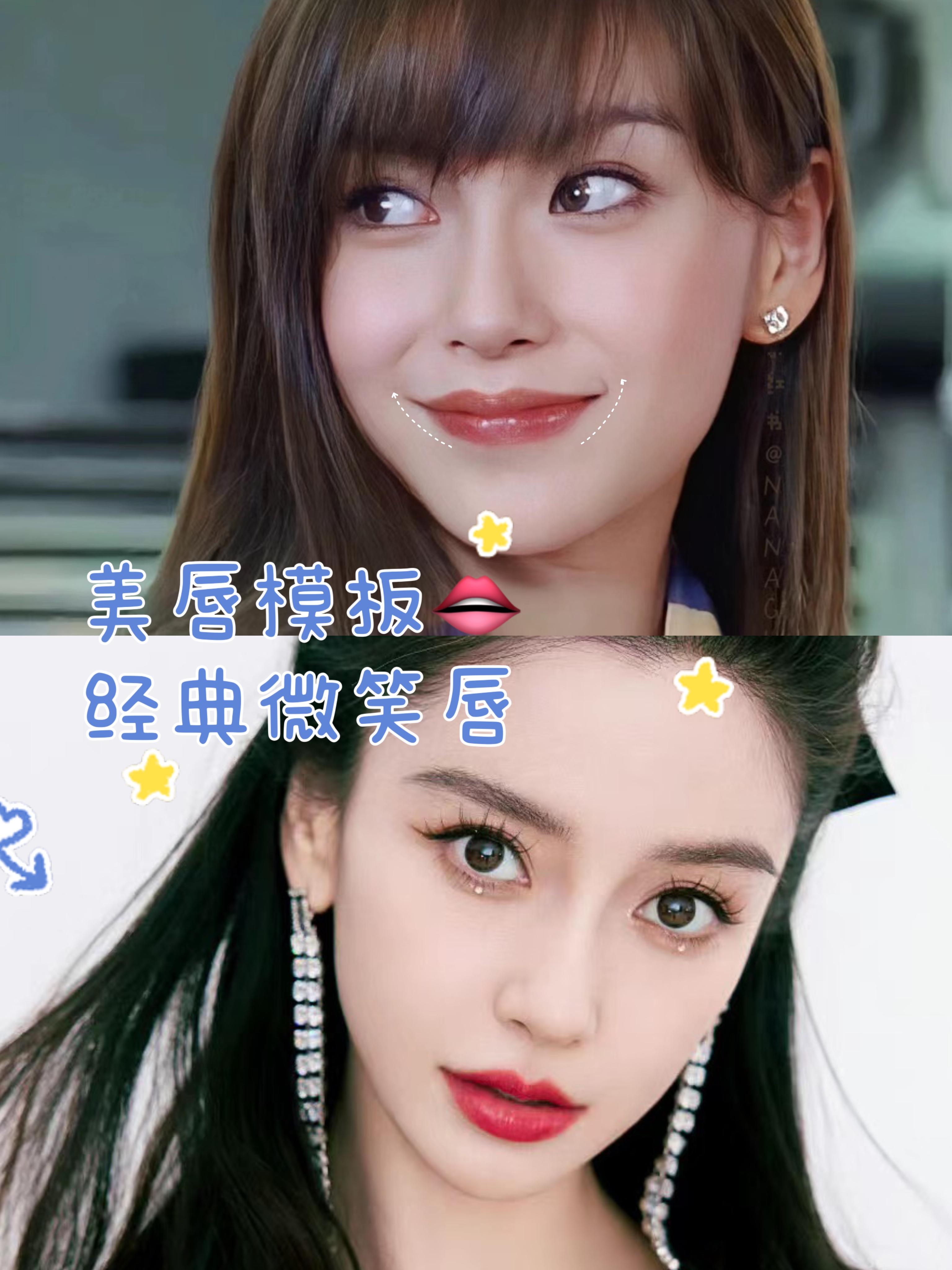 成都微整形燕红 的想法 经典美唇