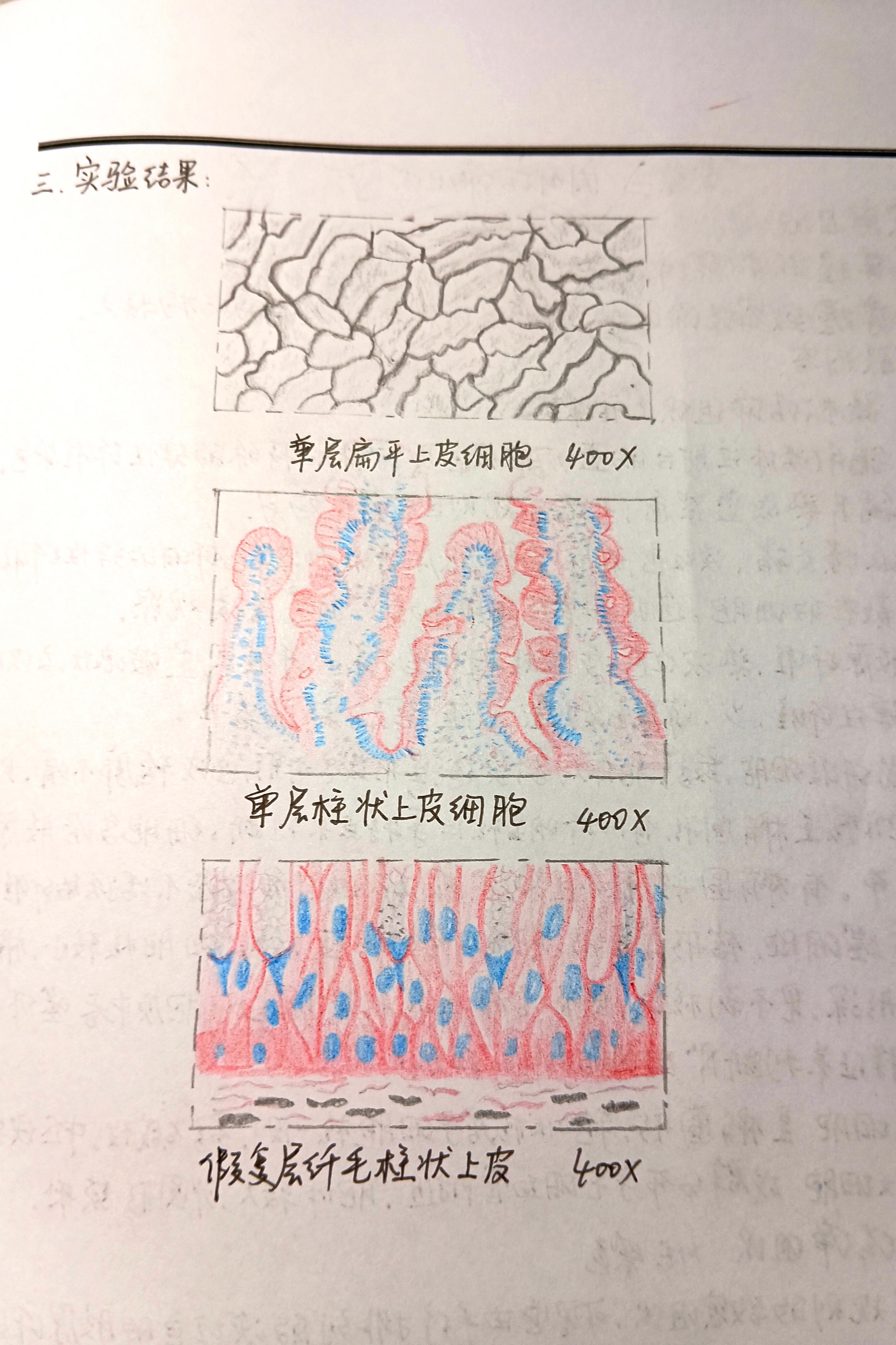 厚壁细胞手绘图图片