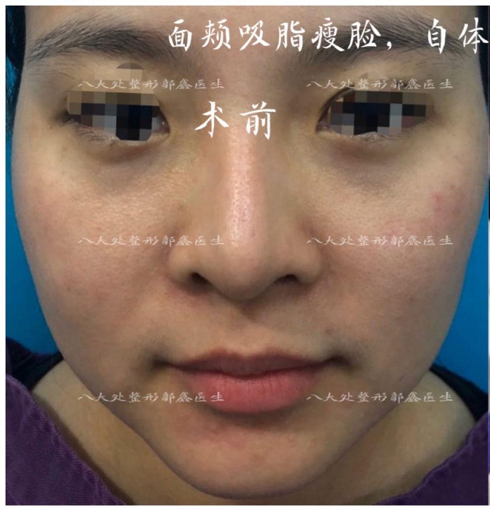 八大处整型医院黄牛挂号绿色通道说到必须做到的简单介绍