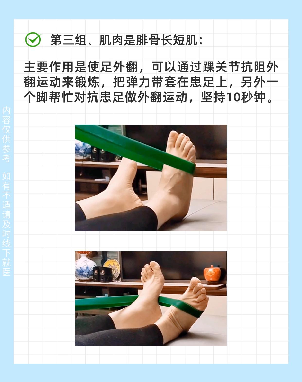 骨科张鹏医生 的想法: 踝关节骨折做好肌肉锻炼,踝关节更稳定