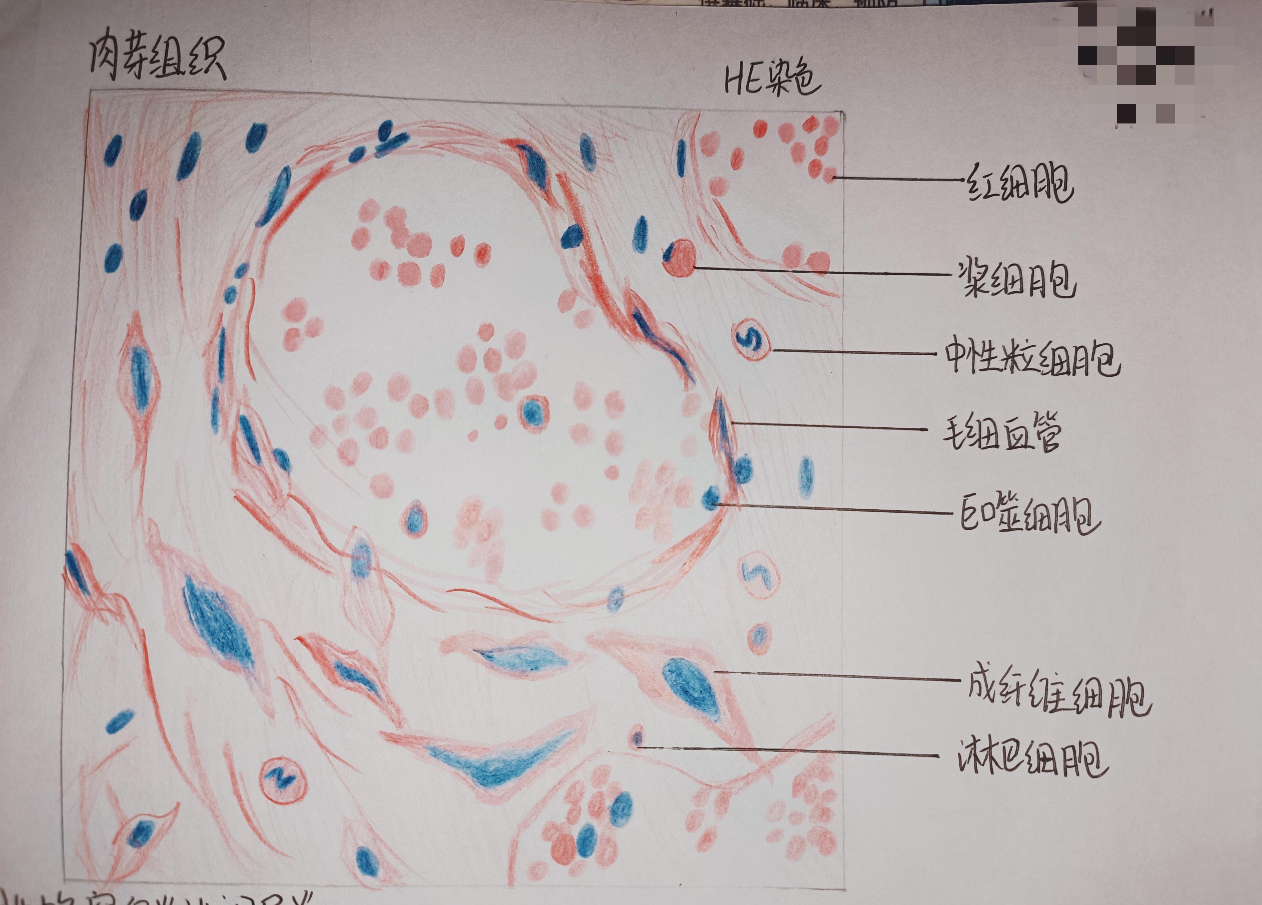 揽星河 的想法: 肉芽组织病理红蓝铅笔绘图 |  a data-pin-topic="