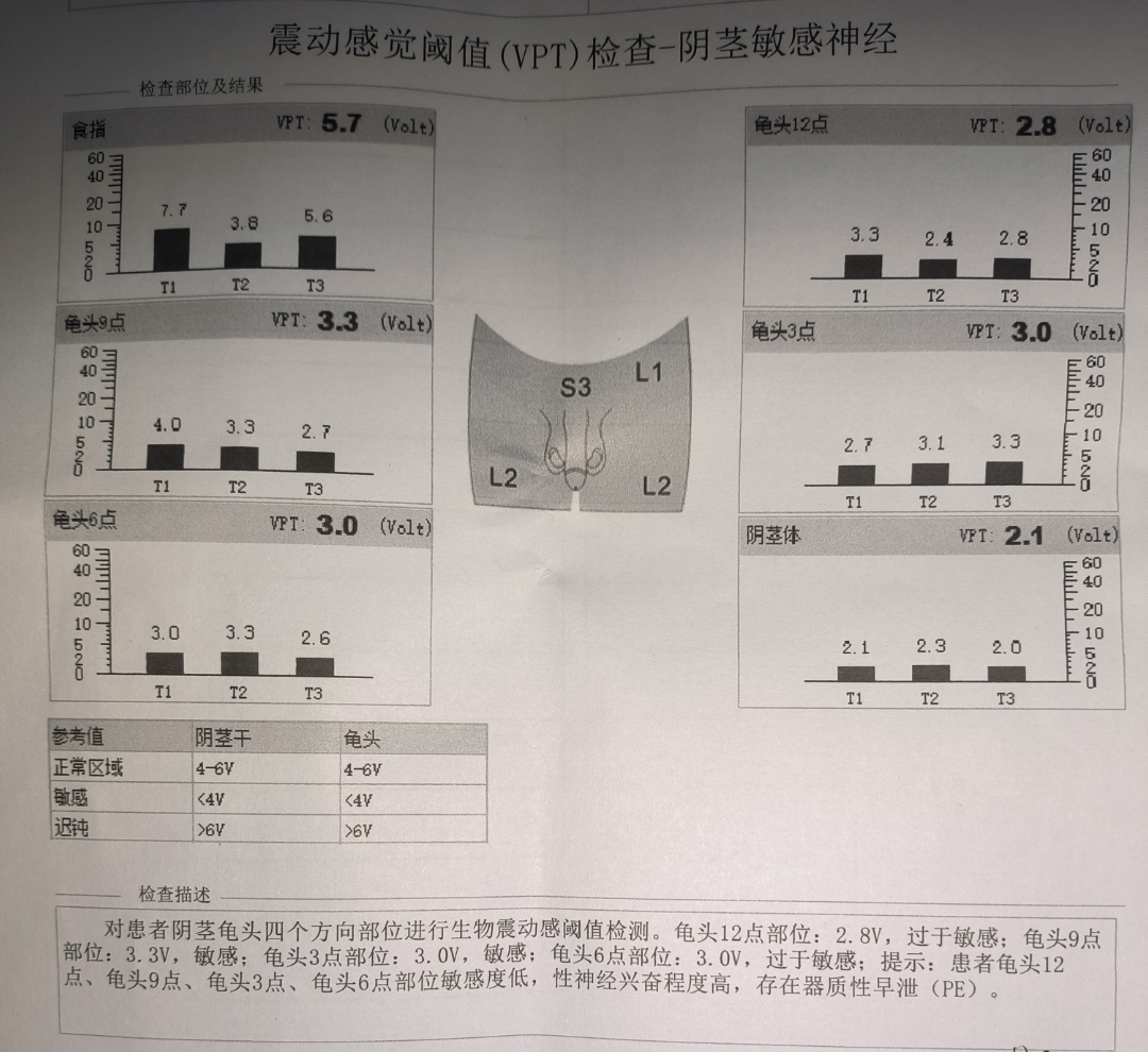 魔仙堡大二新生 的想法: 震动感觉阈值