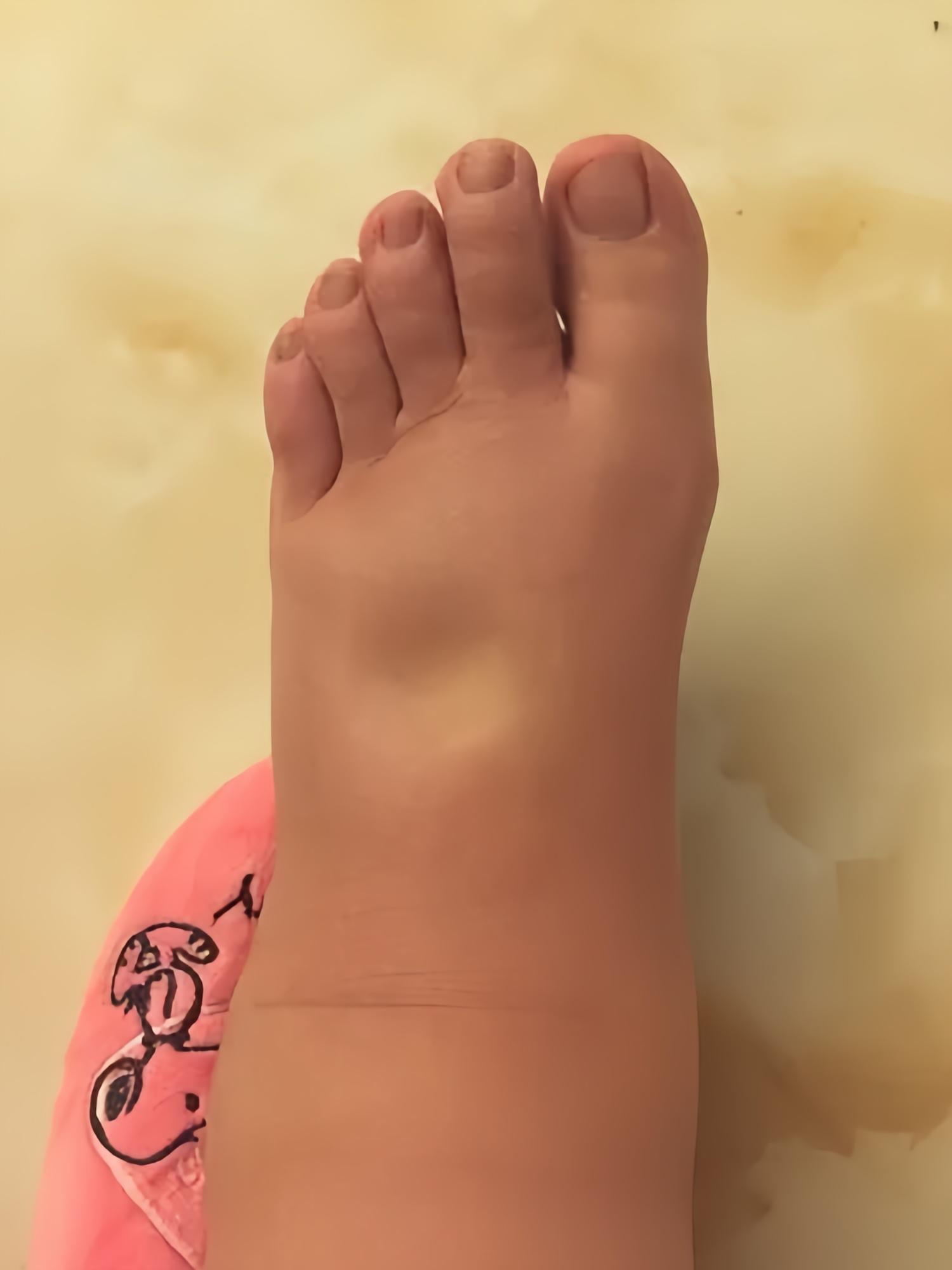 不花1分钱 上班站一整天,到了下午腿就容易变得肿胀,即便少