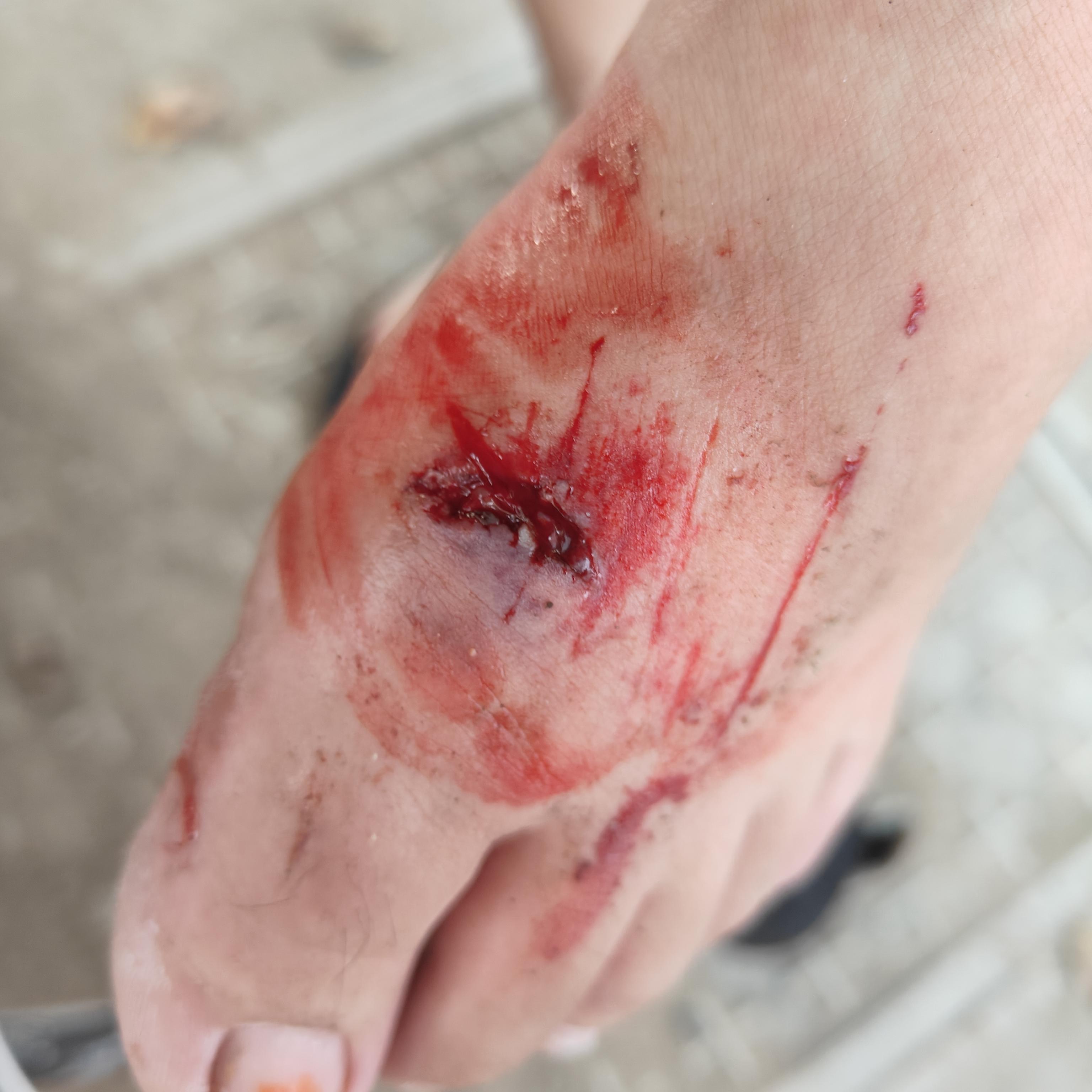 吗 | 美团众包骑手下线一小时候后骑电动车过马路急刹车自己摔倒