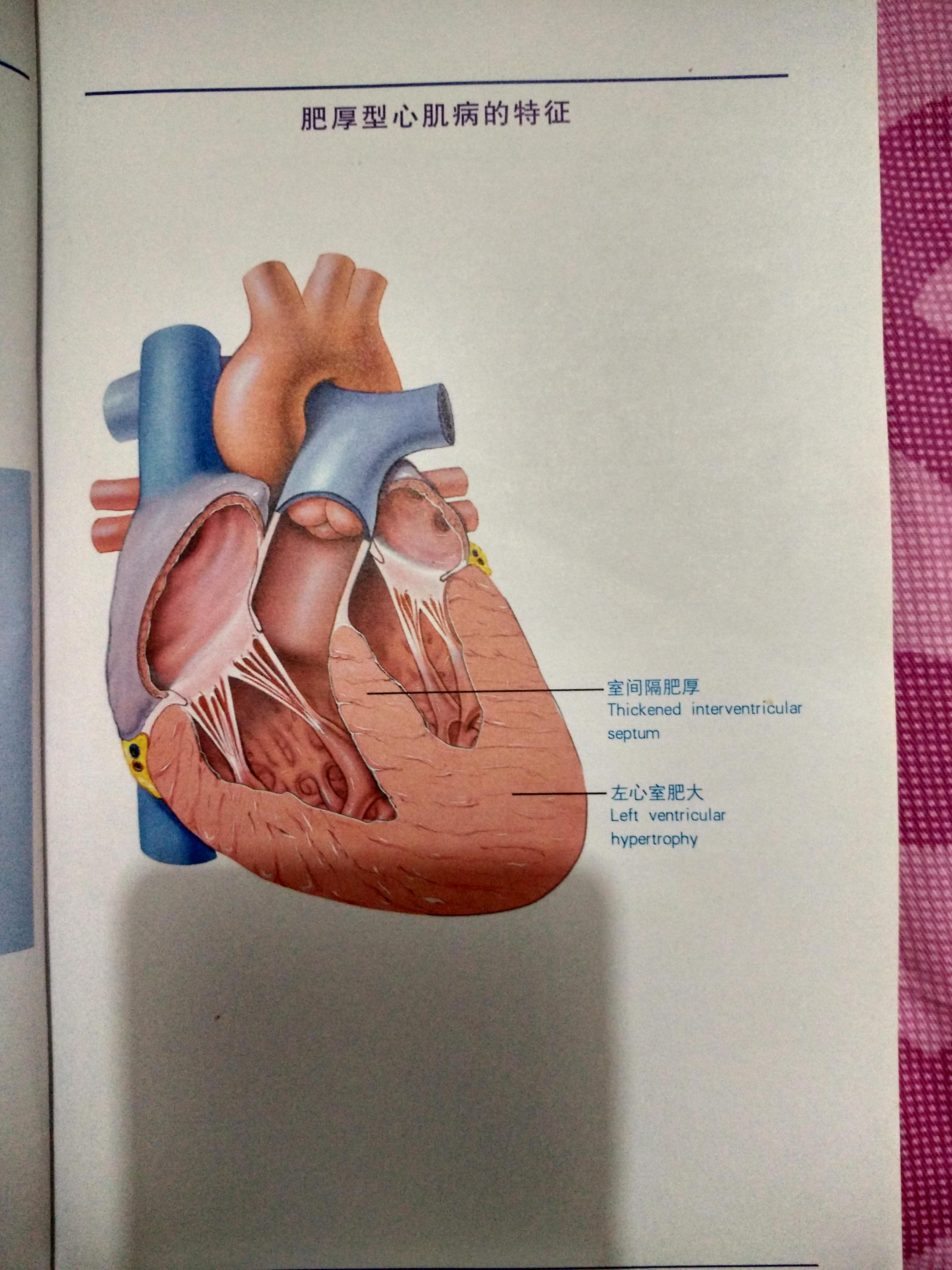 图14-17 舒张期心尖四腔心切面 (二维超声心动图)-外科学-医学