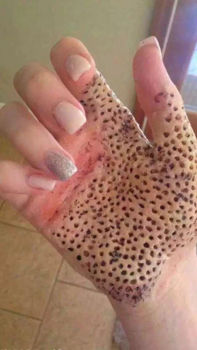 人为什么会有「密集物体恐惧症」?