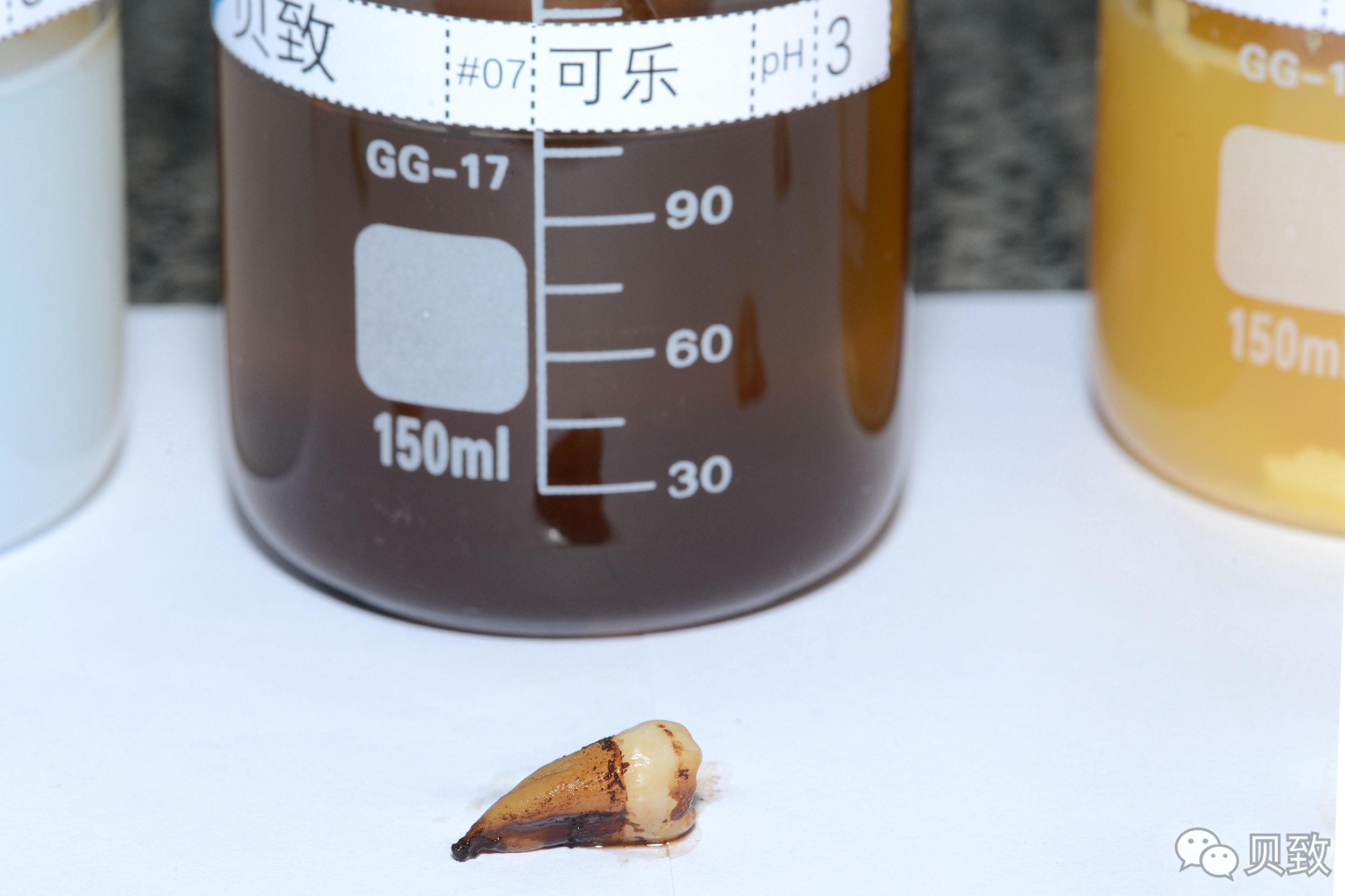 (转)谁能想到,饮料正在“谋杀”我们的牙齿 (转)谁能想到,饮料正在“谋杀”我们的牙齿