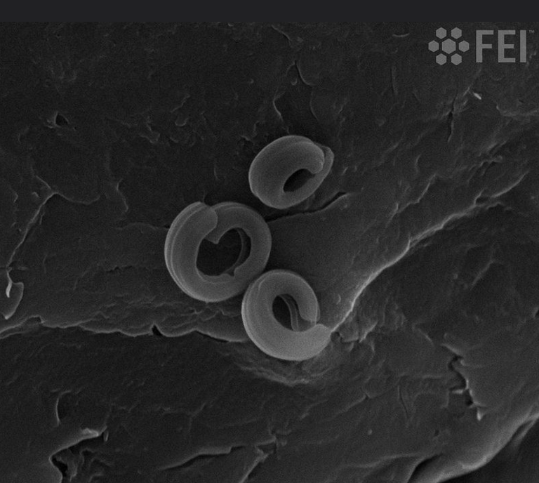 放大500倍的电子显微镜能否查看裂头蚴虫卵? - 知乎