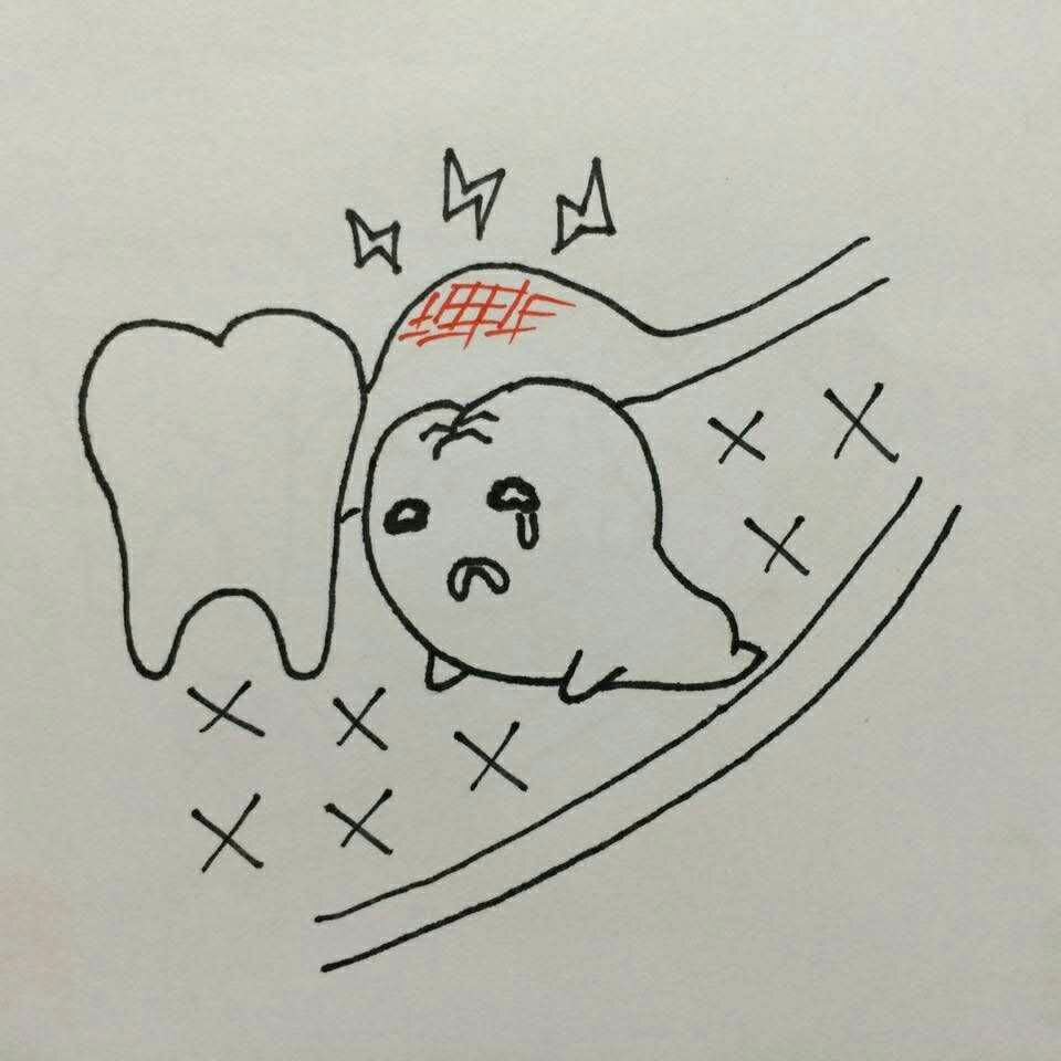 智齿为什么会时不时的疼疼的时候智齿在做什么不疼的时候智齿又在做