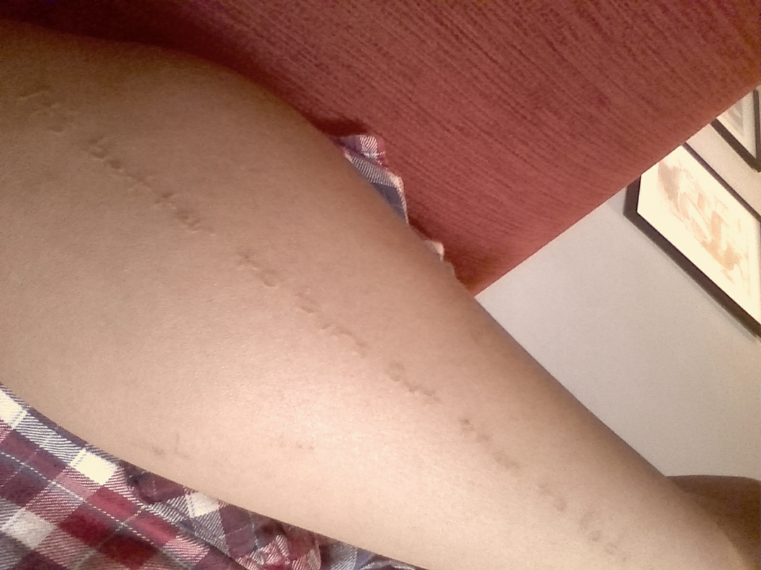 想纹个白色的纹身有纹过白色的纹身的吗有什么缺点吗听说会变黄如图想