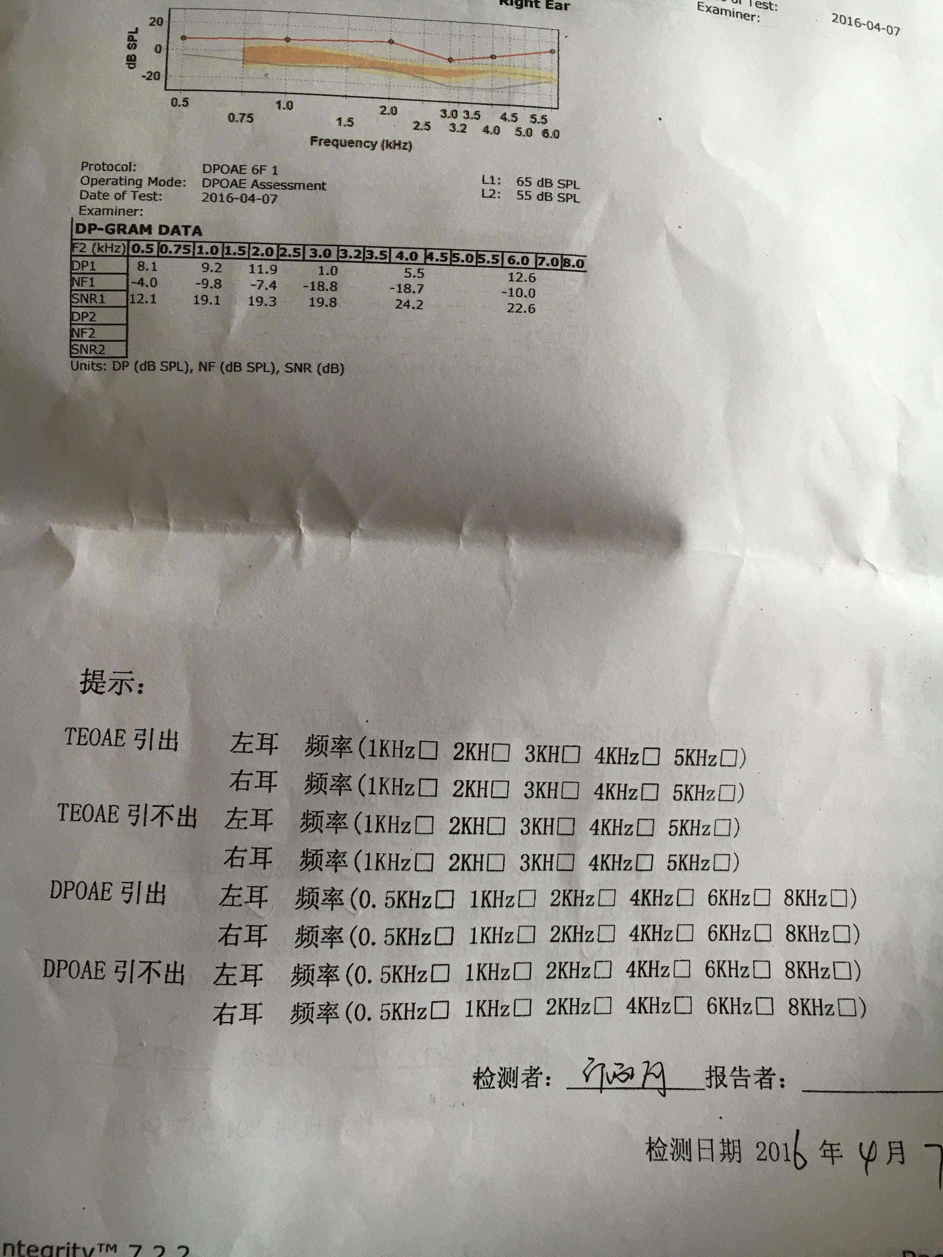 请问有耳鼻喉专家能够解释一下我这个耳声发射检测报告吗非常感激