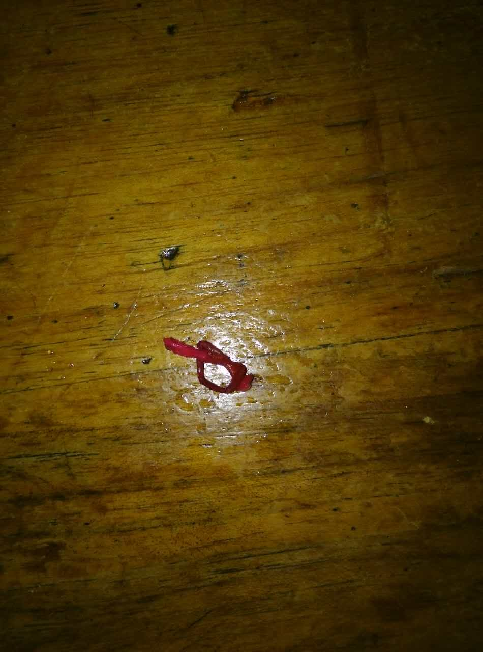 如何用舌头给樱桃梗打结
