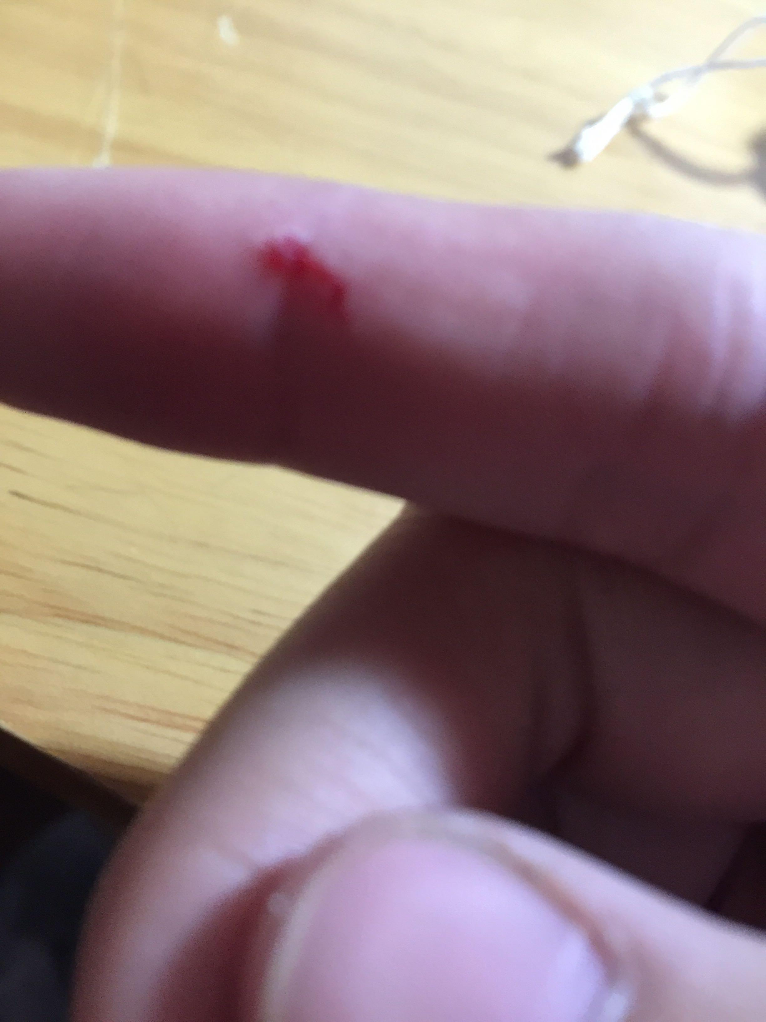 几个月开始用咬胶 3303d11438b6afcf10faa1558b2118bc_r.jpg