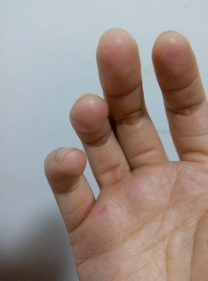 如何克服对吉他调音时调断弦的恐惧