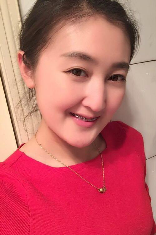 遗传性红血丝 知乎大神护肤求救?