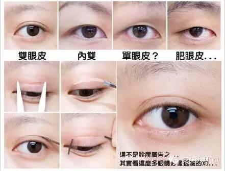一只眼睛内双,一只眼睛单眼皮,怎样让单眼皮也变成内双? - 知乎