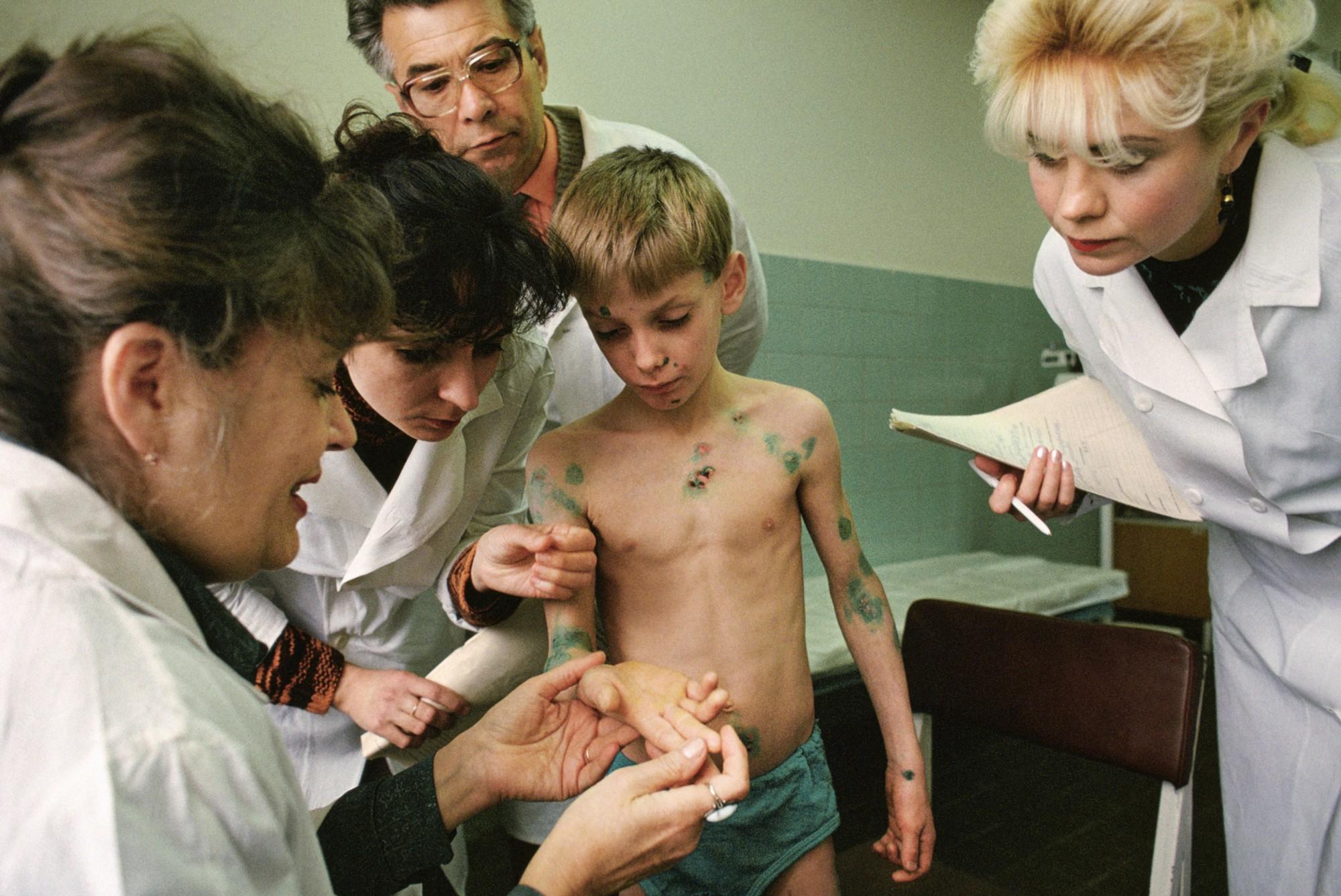 家长和医生归因于切尔诺贝利事故所释放的辐射,以及从工业中心排放的