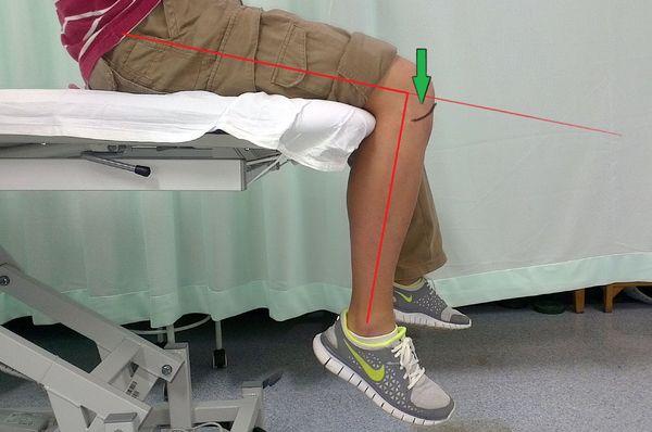 叫膝关节曲度)( knee flexion) 膝关节的角度测量,是大腿的延长线和小