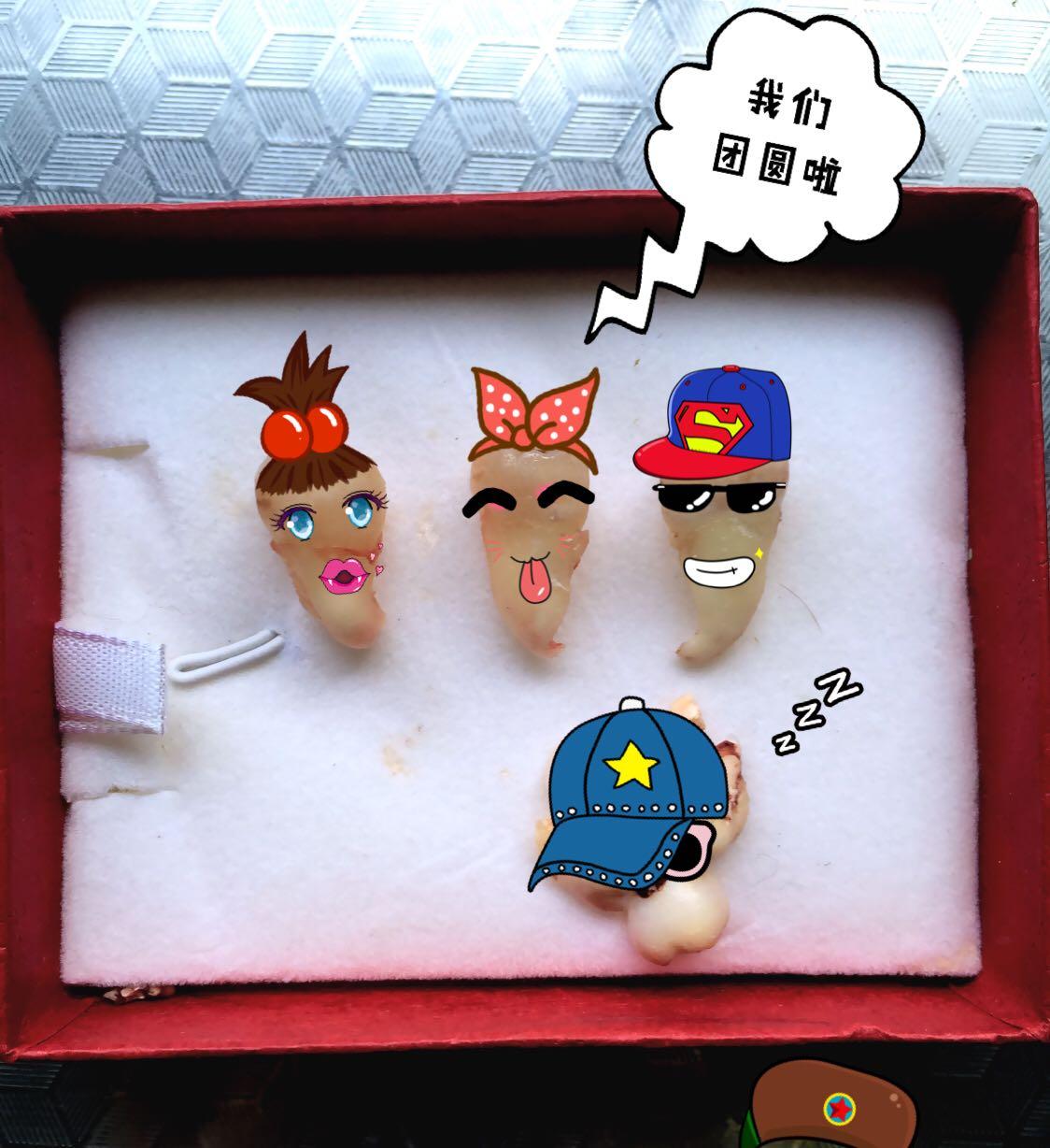 拔智齿有多痛? - 范范万岁万万岁的回答 - 知乎