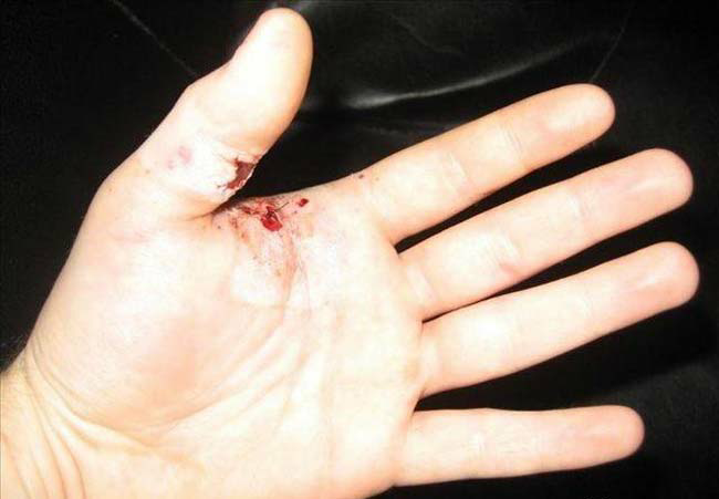 用手指堵住枪口时开枪结果会怎么样?