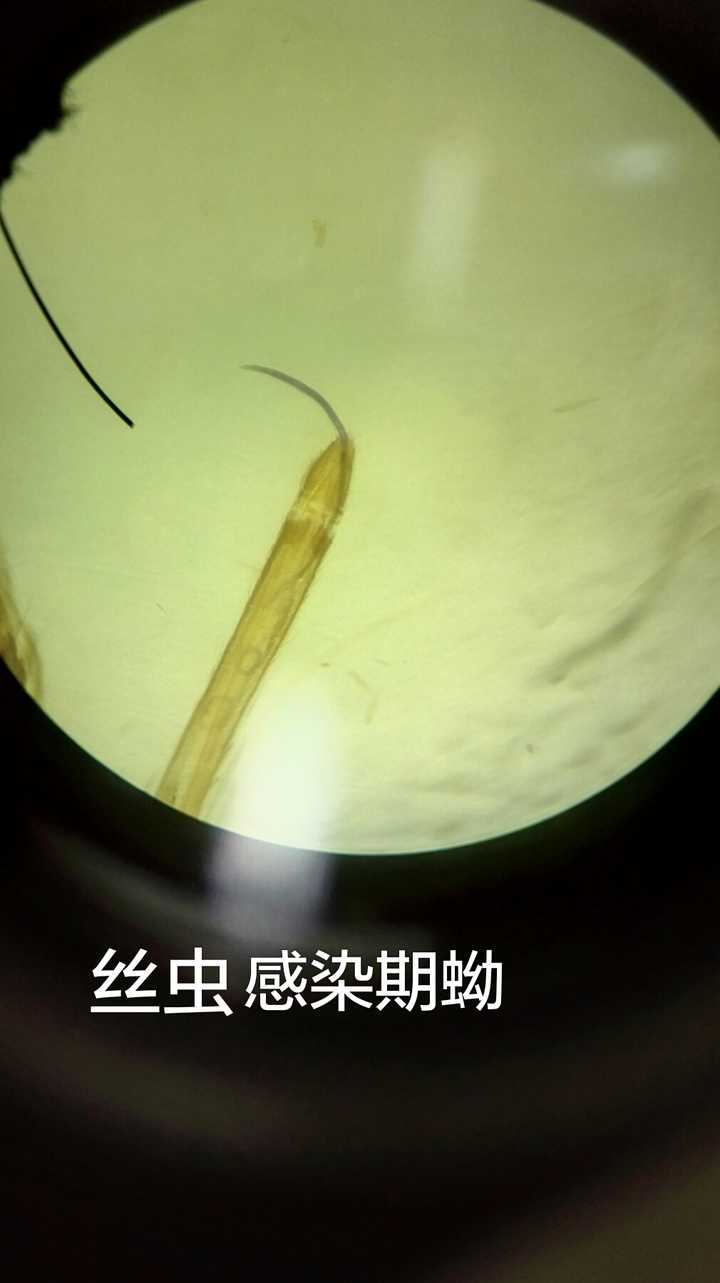 寄生虫病有多可怕 知乎 寄生虫病有多可怕 知乎