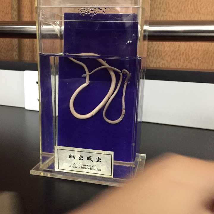 蛔虫能像筷子一样粗细和长短吗?