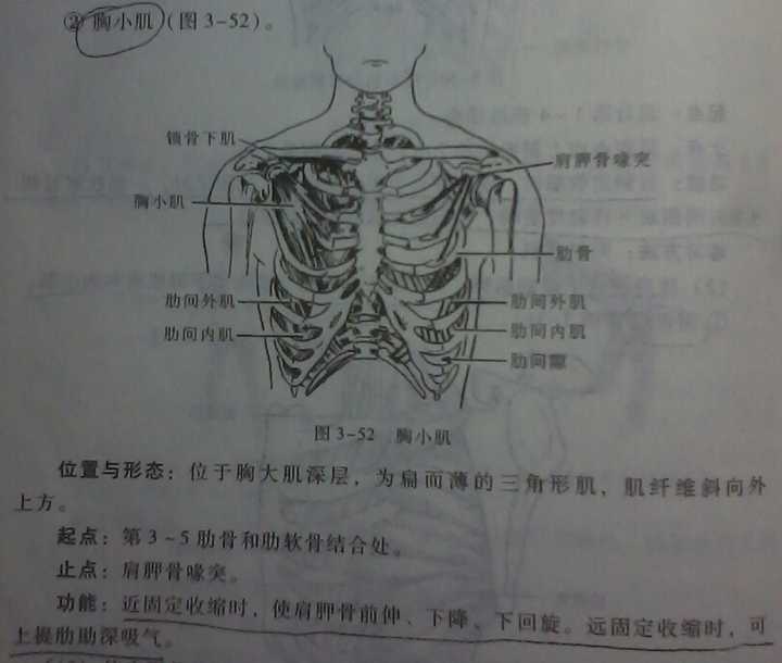 胸大肌三角肌间沟图片