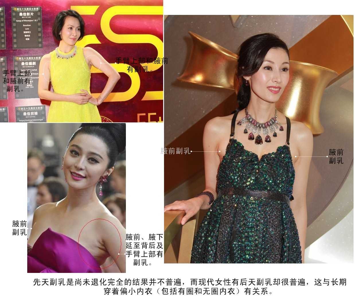 这个问题如果是问哪种文胸可以"减少"副乳,答案是没有.