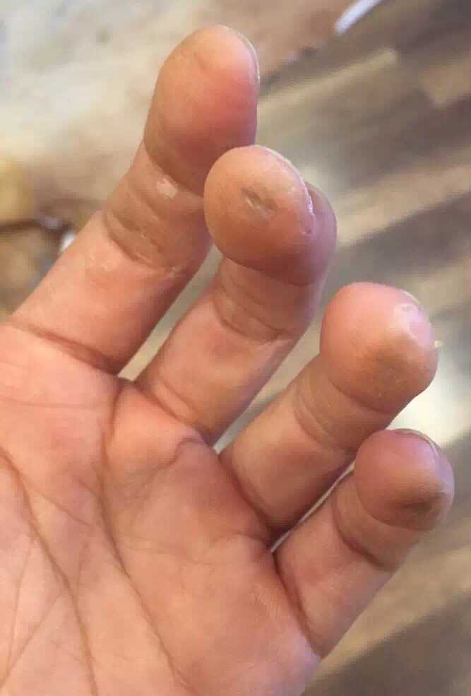 想学琵琶,能否避免手指磨出水泡?