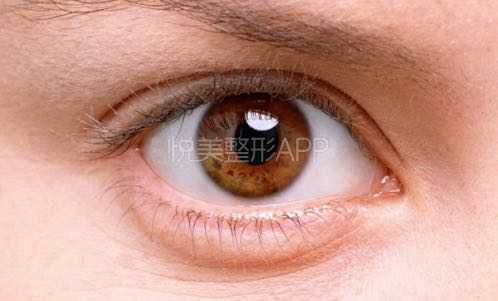 整容看得出来吗 知乎