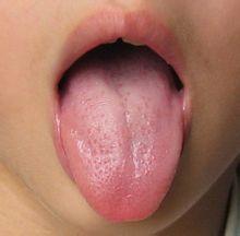 刷牙时怎么去掉舌根部的舌苔 知乎