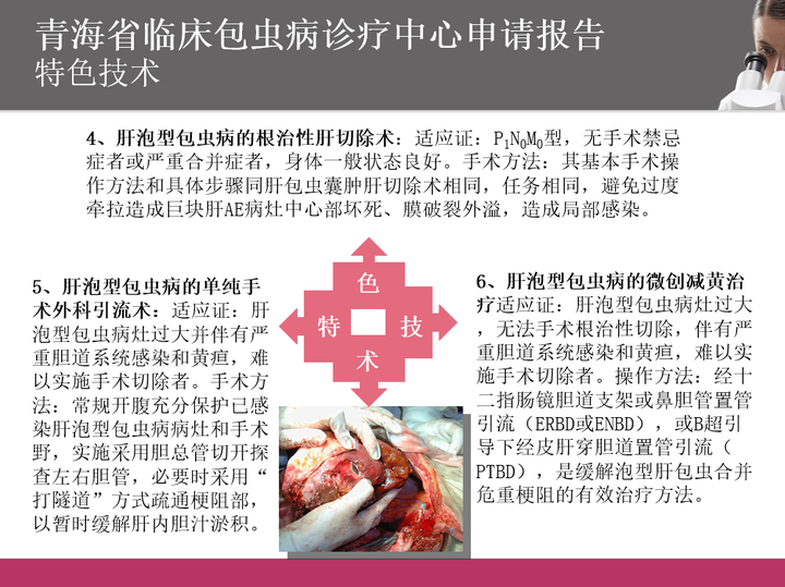 寄生虫病有多可怕 知乎