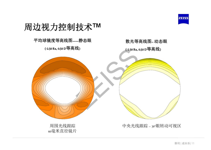离焦镜是什么原理,真的可以缓解近视吗? - 知乎