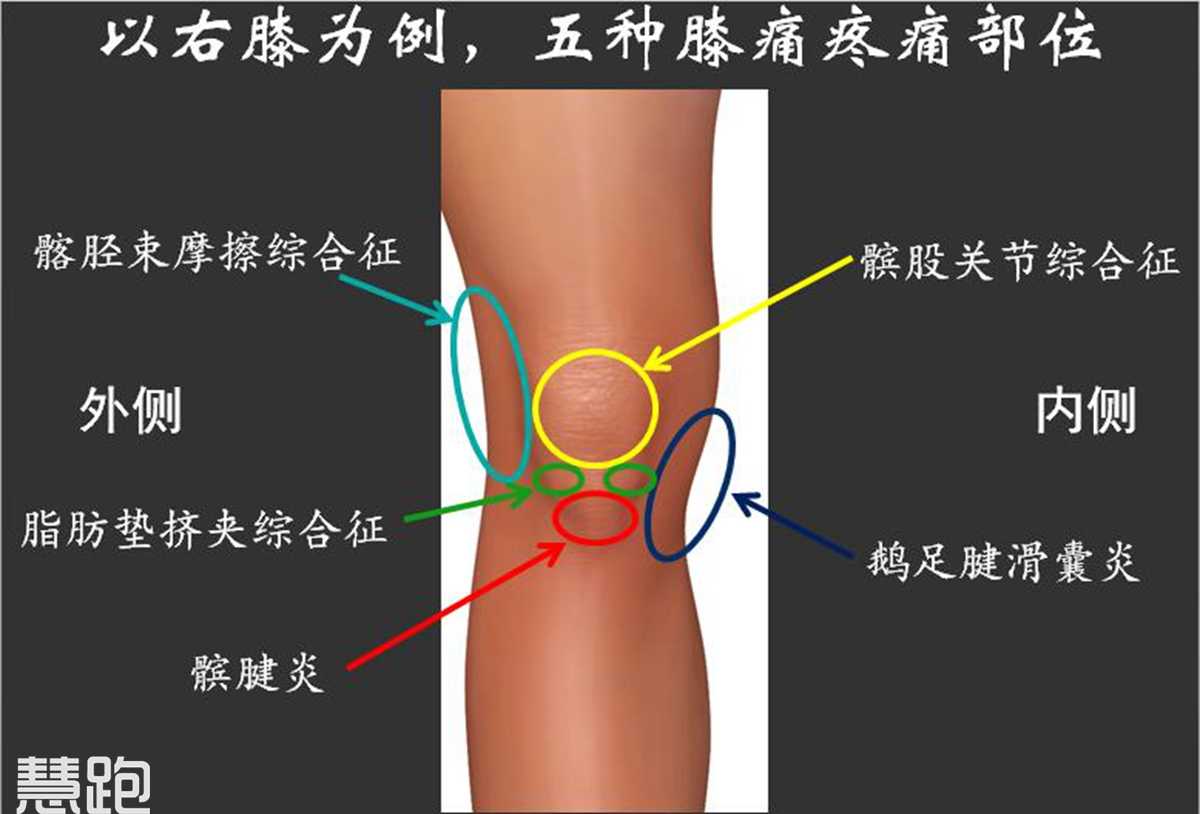 膝盖疼痛位置图图片