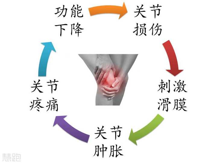 内存在游离体,髌骨劳损,膝关节骨性关节炎等等都有可能引发膝盖积液