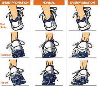 best runner for overpronation