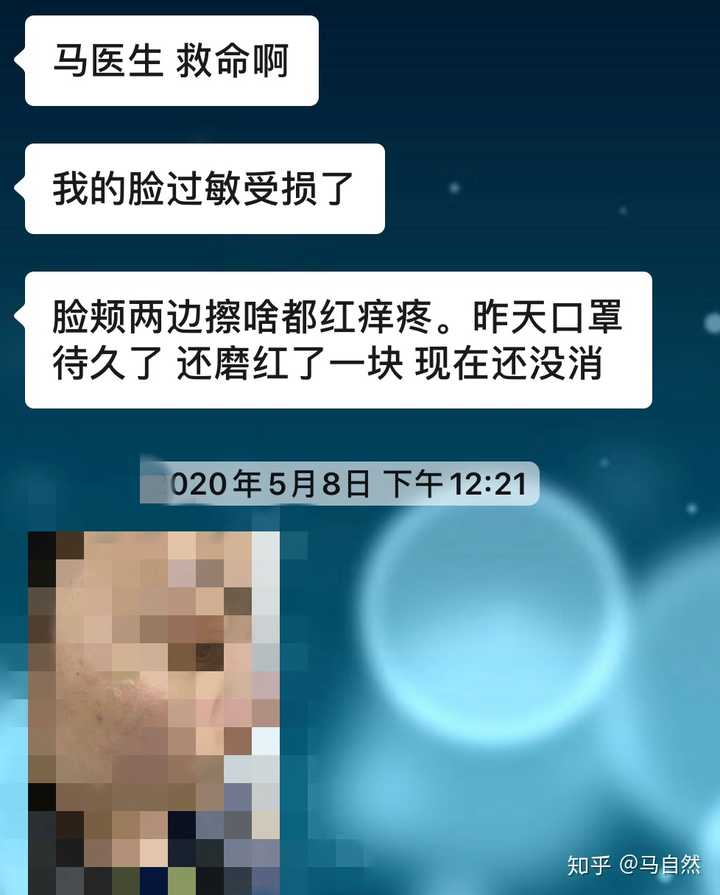 戴了4个月口罩 你的皮肤是变好了还是变差了 知乎