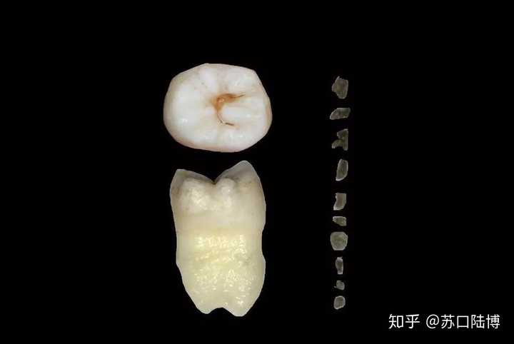 洗牙的过程是怎样的 洗牙后有哪些需要注意的 知乎 洗牙的过程是怎样的 洗牙后有哪些需要注意的 知乎